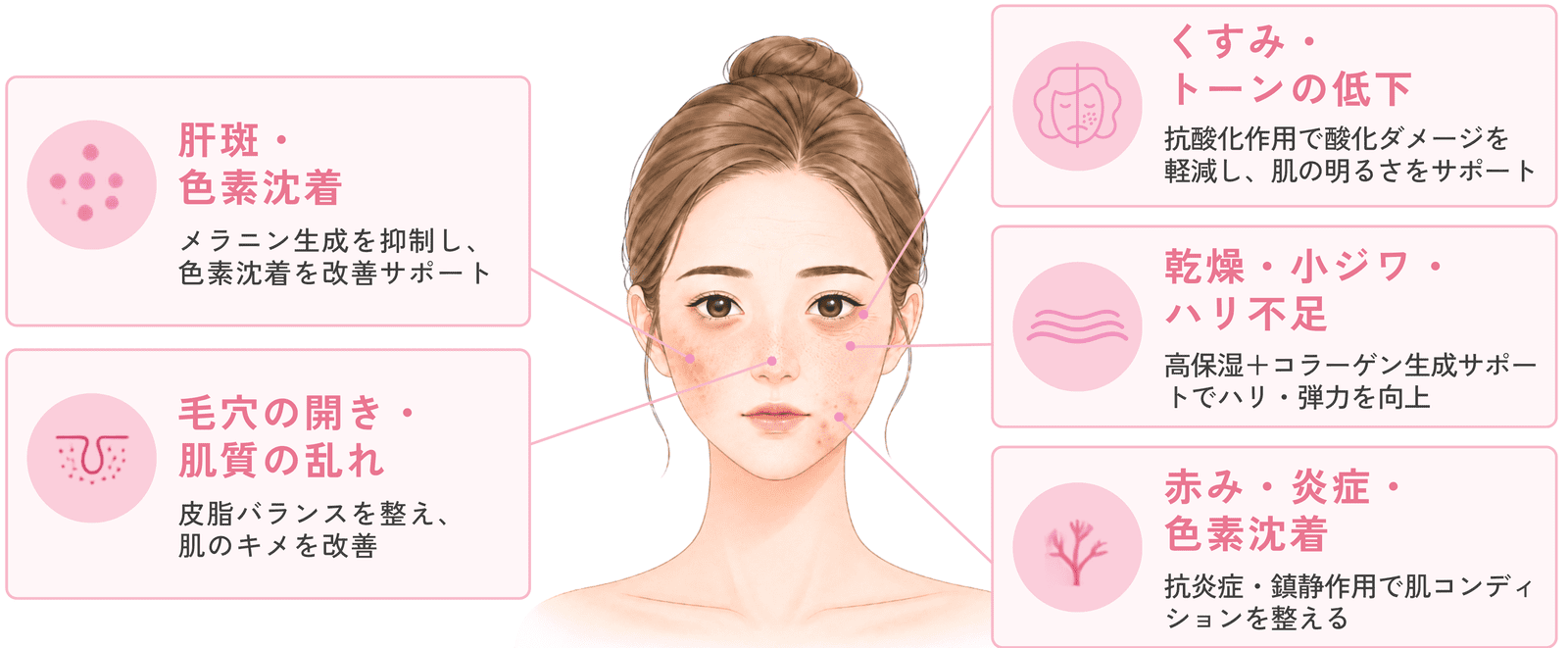 Pink Glowでアプローチするお肌の悩み　肝斑・色素沈着／くすみ・トーンの低下／乾燥・小ジワ・ハリ不足／赤み・炎症・色素沈着／毛穴の開き・肌質の乱れ